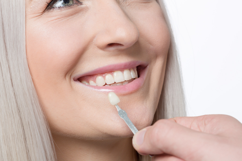 Indianapolis cosmetic dentistry