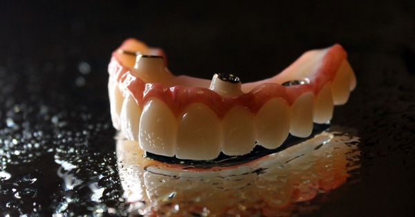 implant dentist Indianapolis