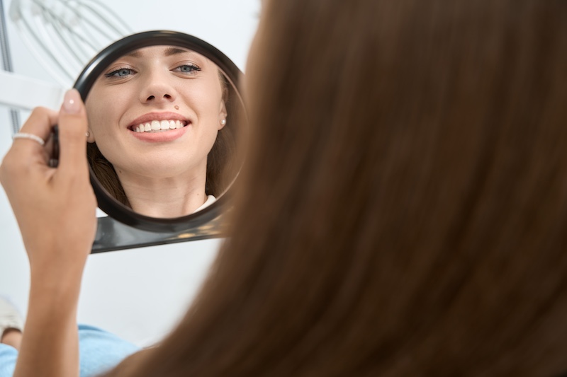 Indianapolis smile makeover